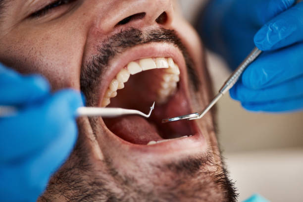 Best Emergency Orthodontic Services in Tipp City, OH