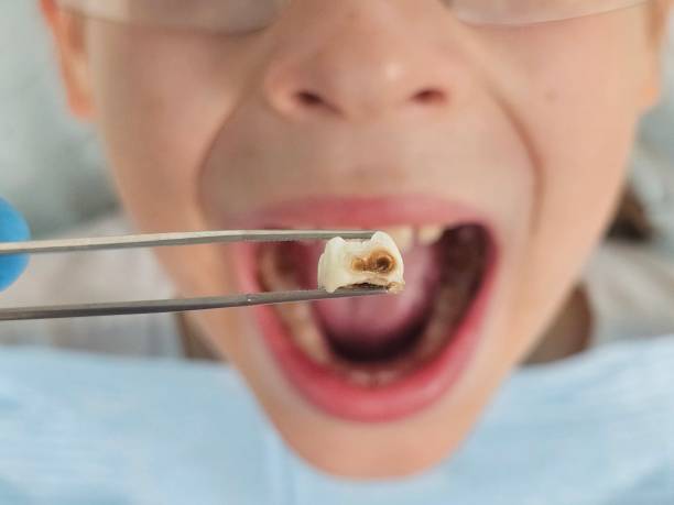 Best Emergency Denture Repair in Tipp City, OH