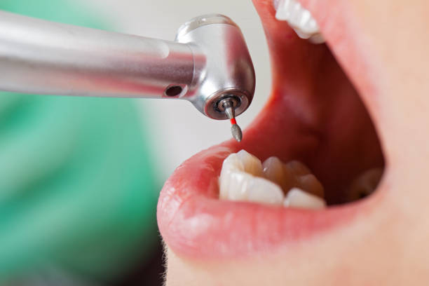 Best Cosmetic Emergency Dentistry in Tipp City, OH